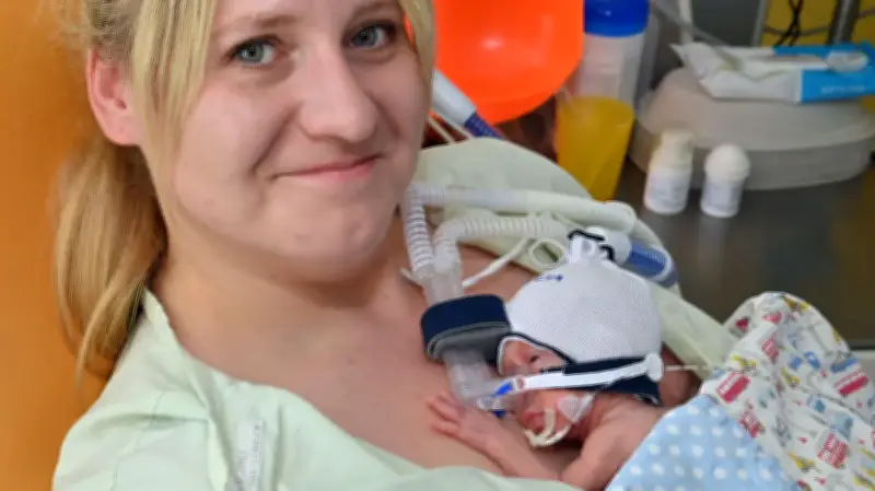 Frühchen Ryszard: 630 Gramm bei Geburt, jetzt 900 Gramm – 1000. Geburt im Klinikum Südstadt